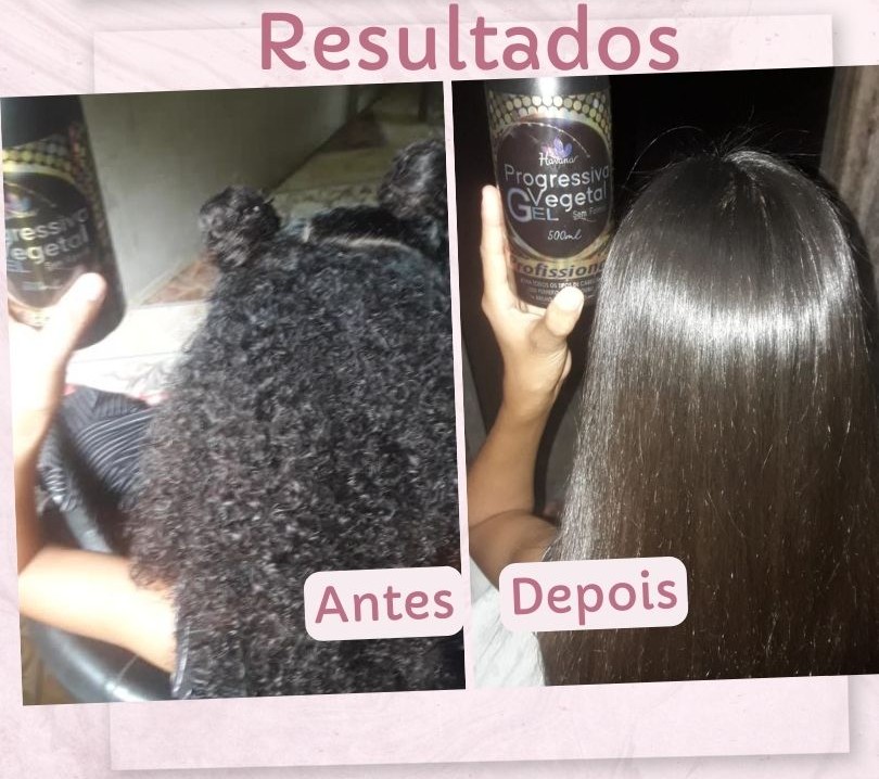 Antes & Depois 3