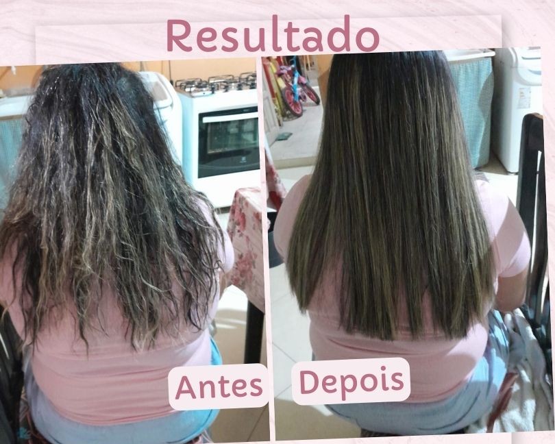 Antes & Depois 4